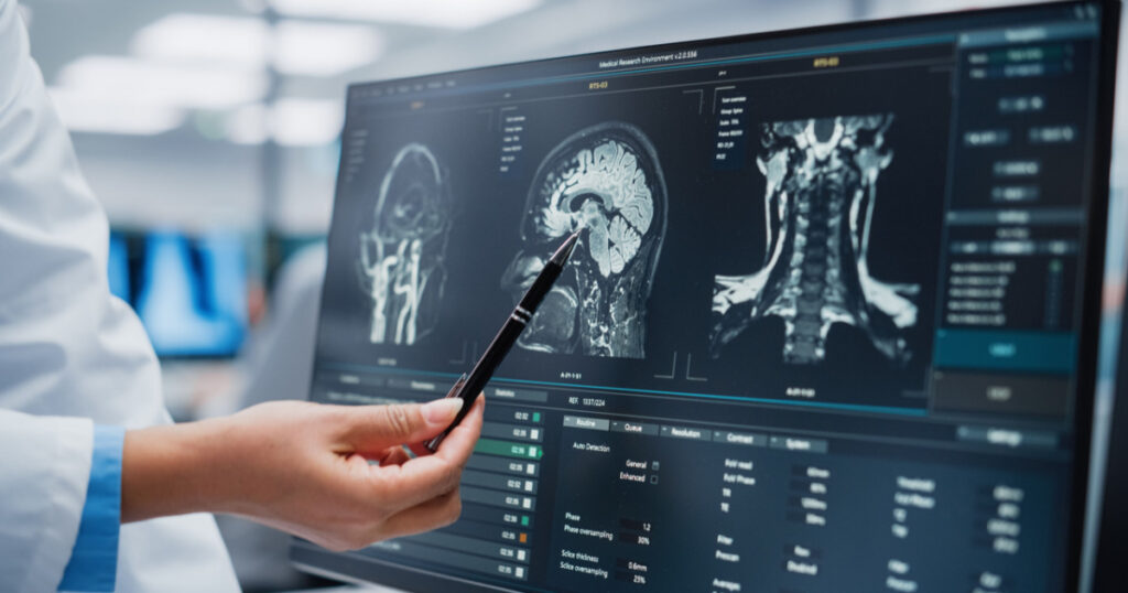 Medical Hospital: Neurologist and Neurosurgeon Talk, Use Computer, Analyse Patient MRI Scan, Diagnose Brain. Brain Surgery Health Clinic Lab: Two Professional Physicians Look at CT Scan. Close-up