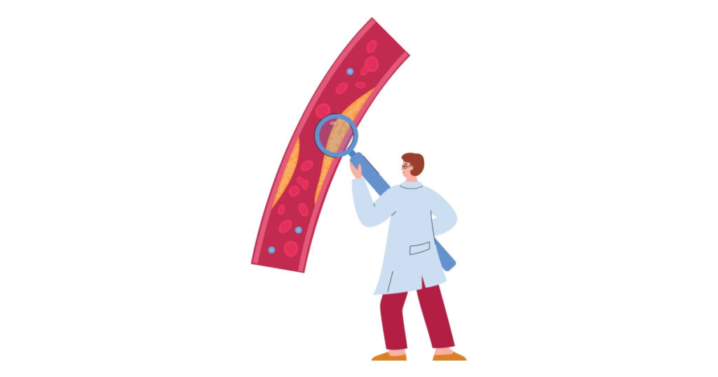 Doctor checks the level of cholesterol in human blood vessels, flat cartoon vector illustration isolated on white background. Care health and heart disease prevention.
