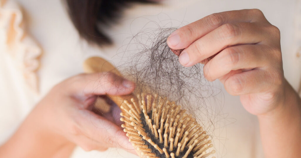 Healthcare concept.Closeup hair loss,hair fall in hairbrush stress problem of woman.