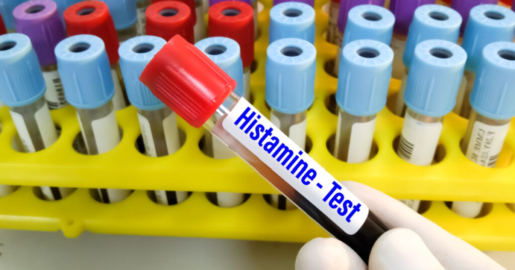 Blood sample for Histamine blood test, to diagnosis of anaphylaxis, mastocytosis, or mast cell activation.