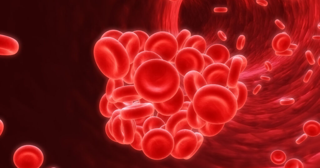 blood clot
