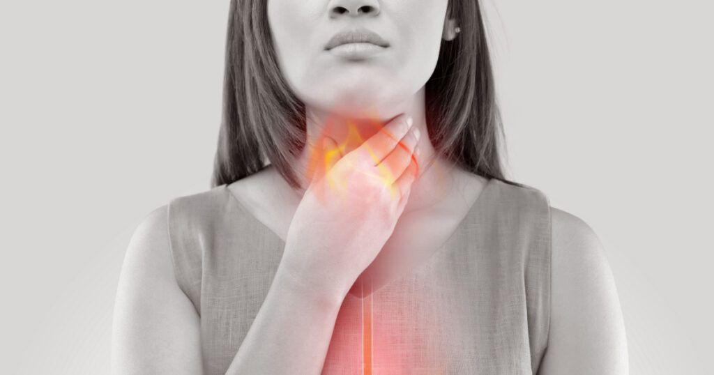 Woman Suffering From Acid Reflux Or Heartburn-Isolated On White Background
