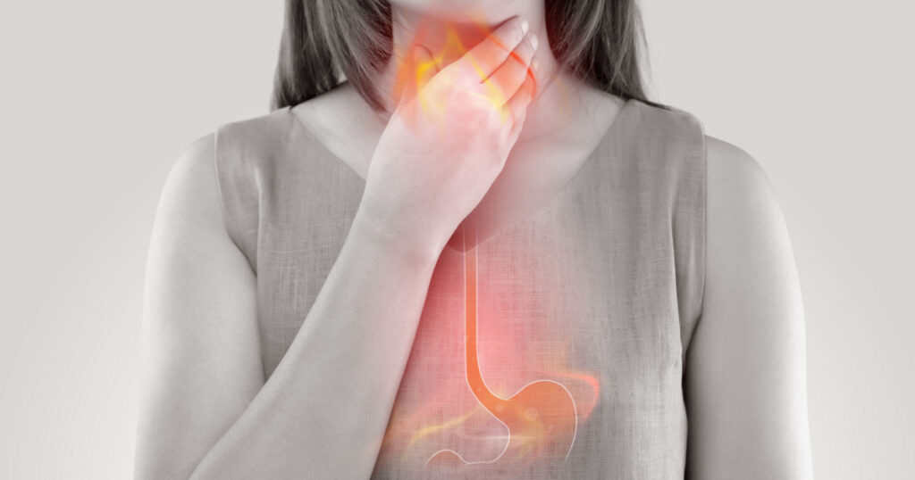 Woman Suffering From Acid Reflux Or Heartburn-Isolated On White Background