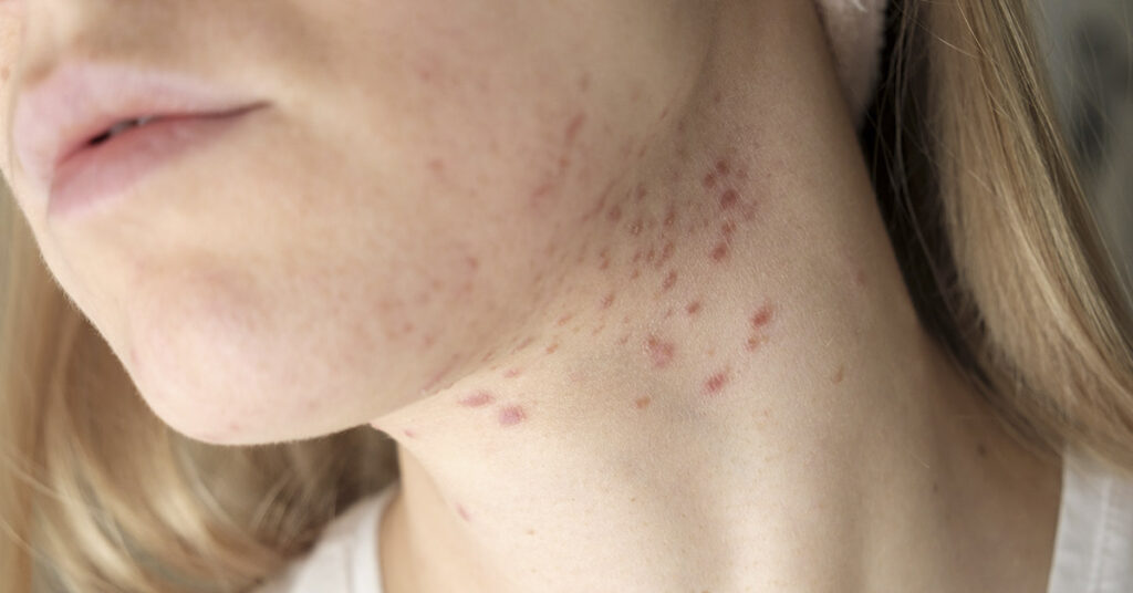 20 Signs Your Body is Out of Balance, and Something is Wrong