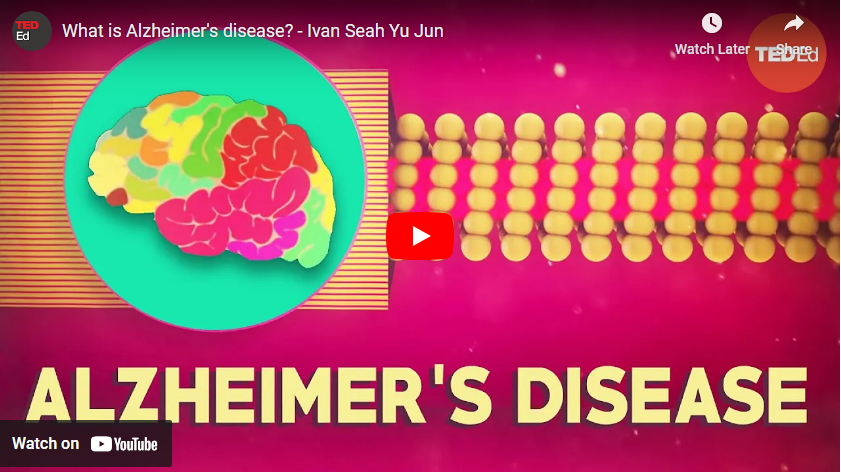 alzheimer's video