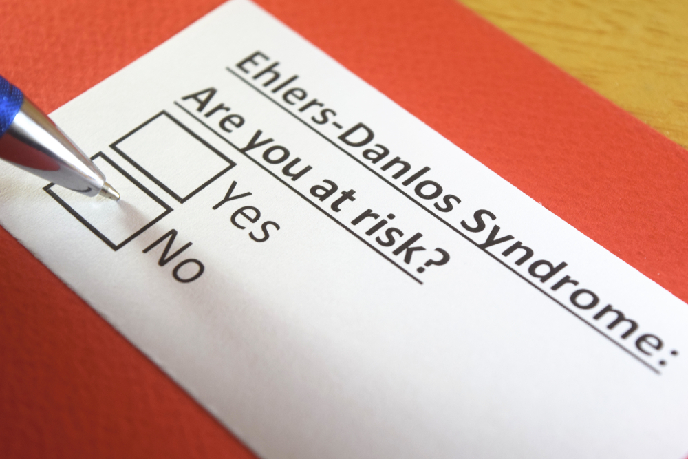 Ehlers-danlos syndrome: Are you at risk? yes or no