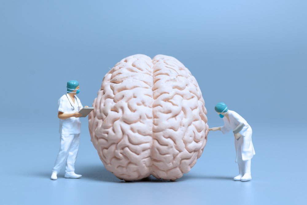 Miniature Doctor checking and analysis alzheimer's disease and dementia of brain, Science and medicine concept