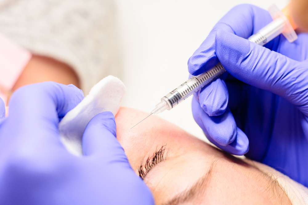 Milium on the face, removal of milia with a syringe in cosmetology. new