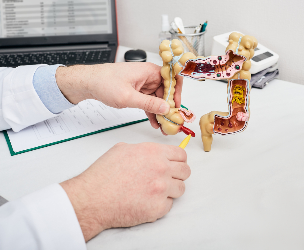 Doctor pointing pen to inflamed appendicitis using a intestines anatomical model. Consultation gastroenterologist for a patient with stomach pain