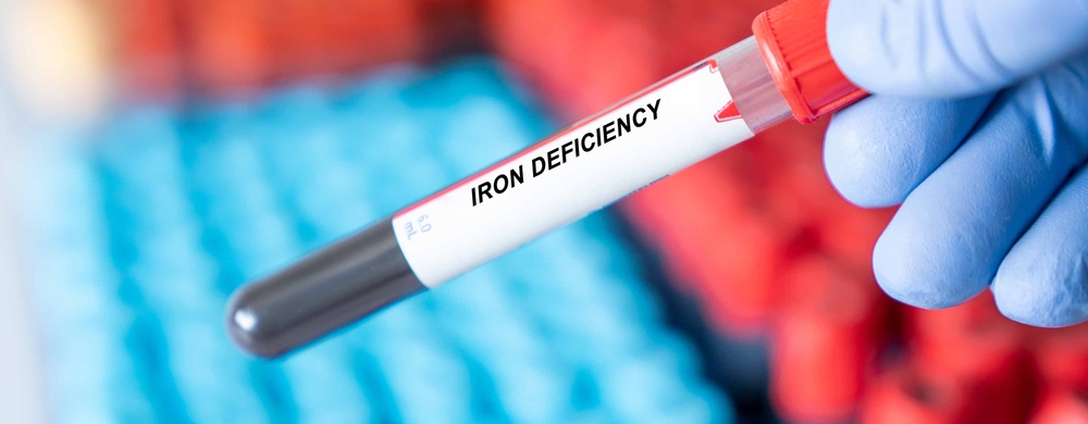 Iron Deficiency. Iron Deficiency disease blood test inmedical laboratory