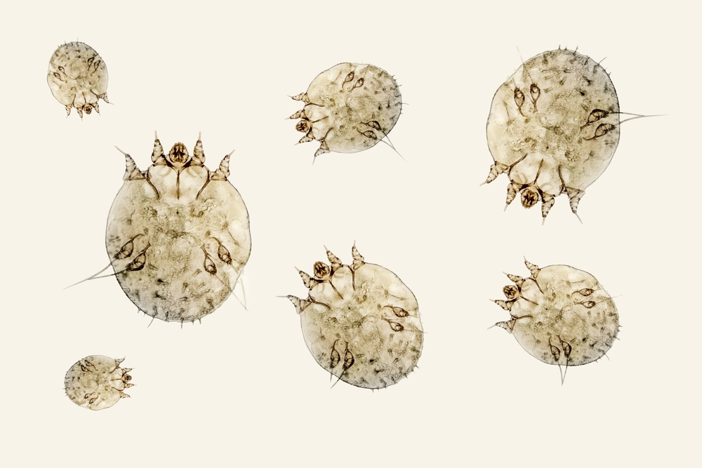 Many scabies mites, itch-mites parasitic microorganism of human skin, microscope view