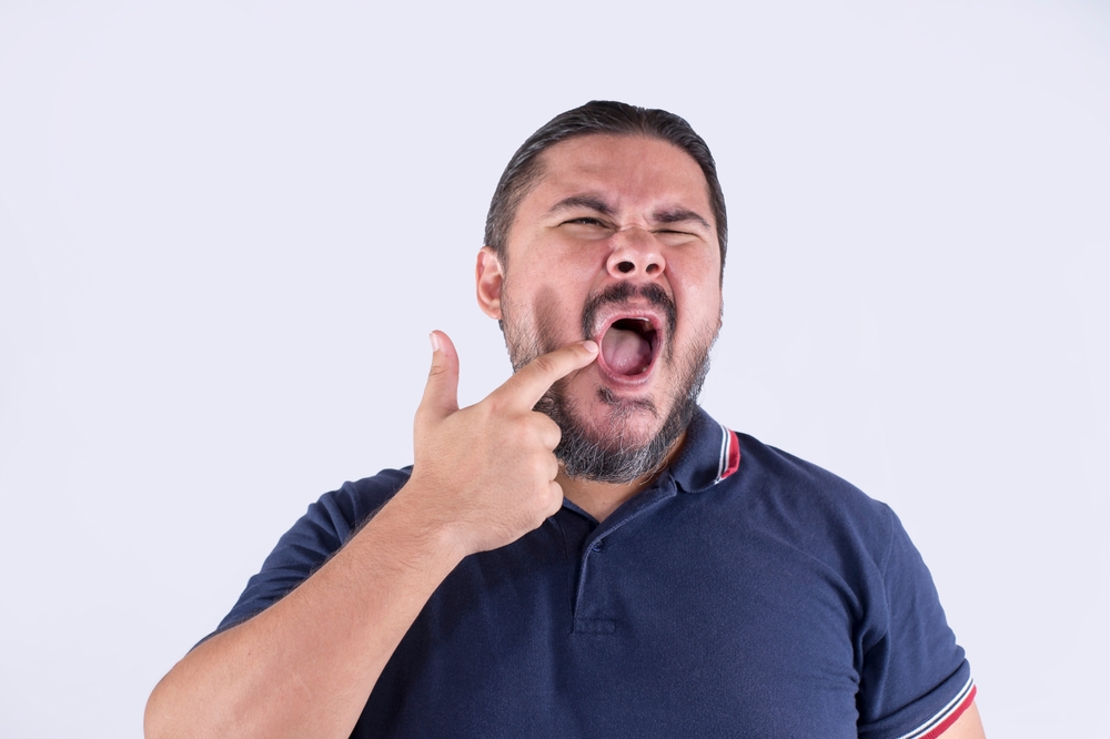 A man suffering from angular cheilitis. Pointing out the cracked, irritated sore on the corner of his mouth. Feeling discomfort and annoyance. Isolated on a white background