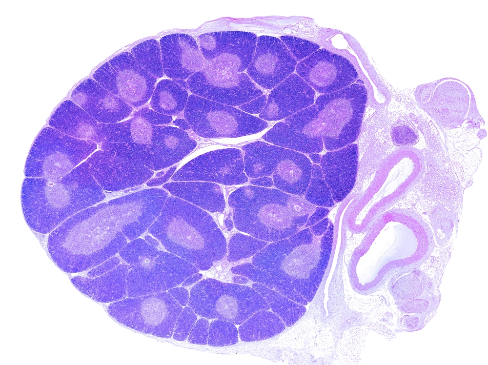 Very low power light microscope micrograph of a young thymus. In the thymic lobules, the peripheral cortex appears more stained. The paler medulla shows many Hassall's corpuscles. HE stain