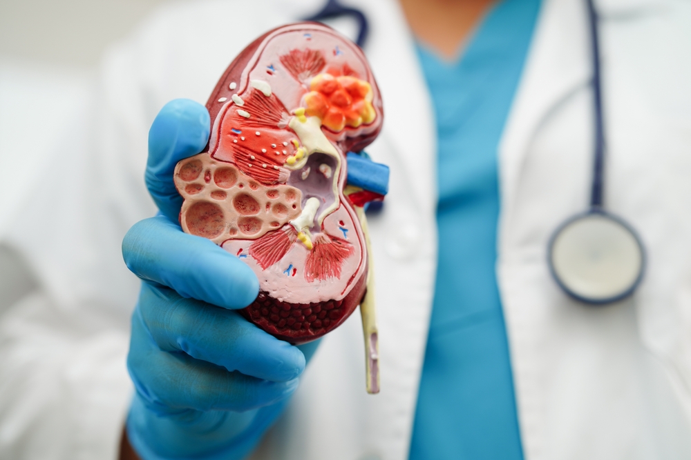 Chronic kidney disease, doctor holding model for treatment urinary system, urology, Estimated glomerular filtration rate eGFR.
