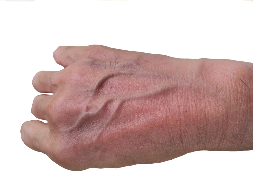 The veins, close up of back of hand, blood vessels and for old people, thin, there are several bulging veins. Clearly visible wrinkled, dull, isolated on white background and health care concept.
