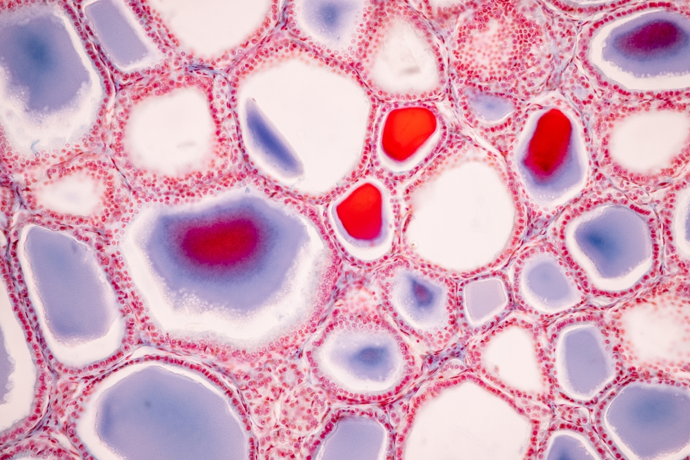 Showing Light micrograph of the Thyroid gland and Thymus gland human Child under the microscope for education in the laboratory.