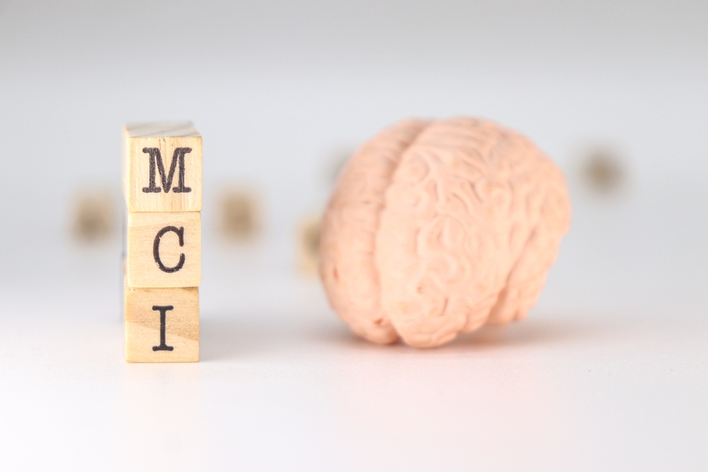 MCI abbreviation Mild Cognitive Impairment concept on white background with a human brain

