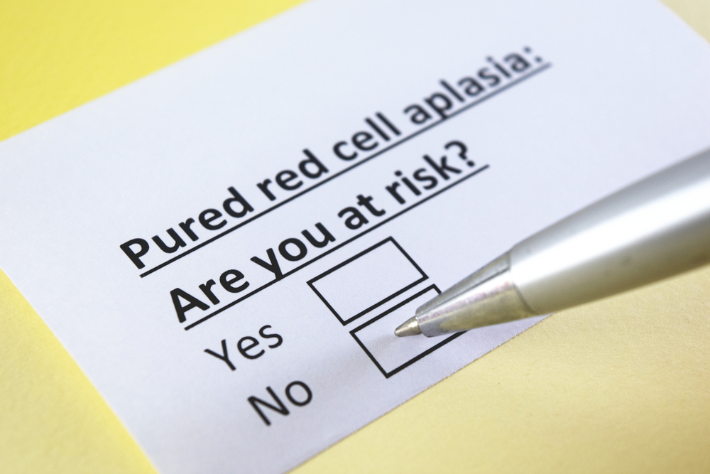 Pured red cell aplasia: are you at risk? yes or no