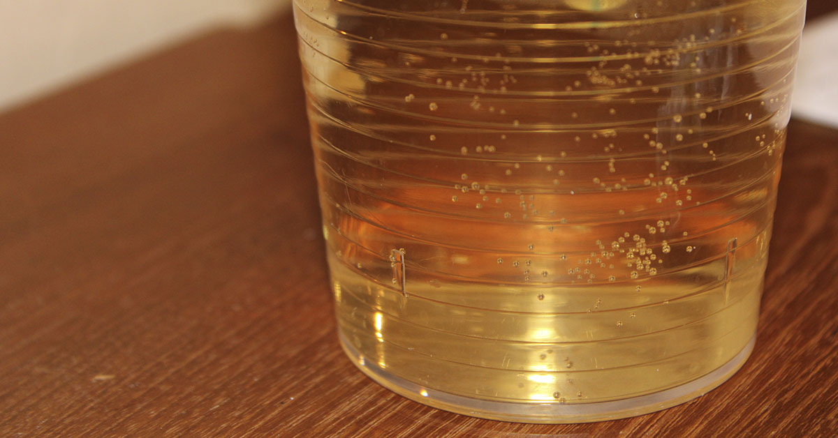 This is Why Most Ginger Ales Won’t Actually Settle Your Stomach