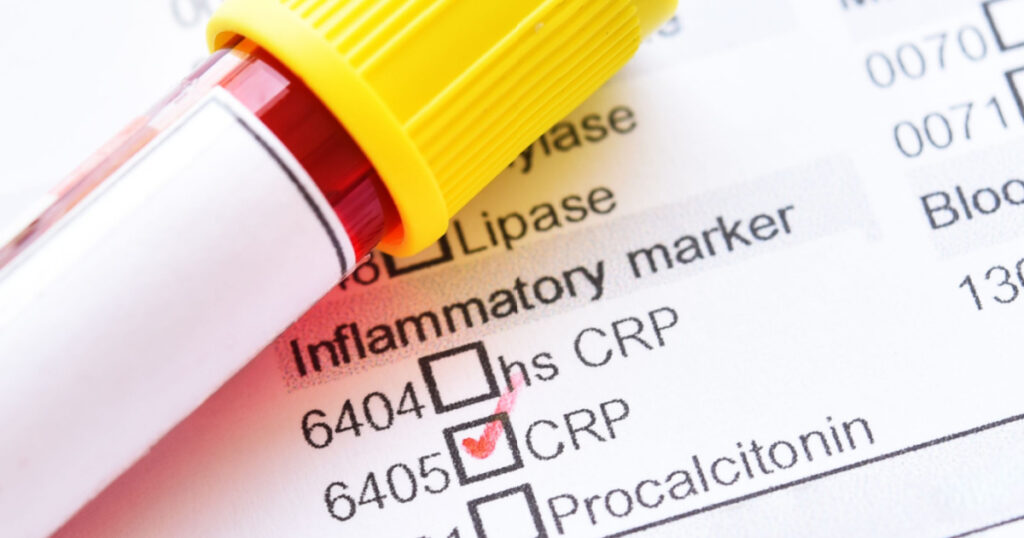 Blood sample tube with laboratory requisition form for C-reactive protein (CRP) test
