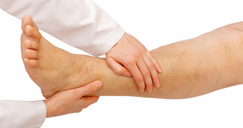 General physical examination for the lower limbs