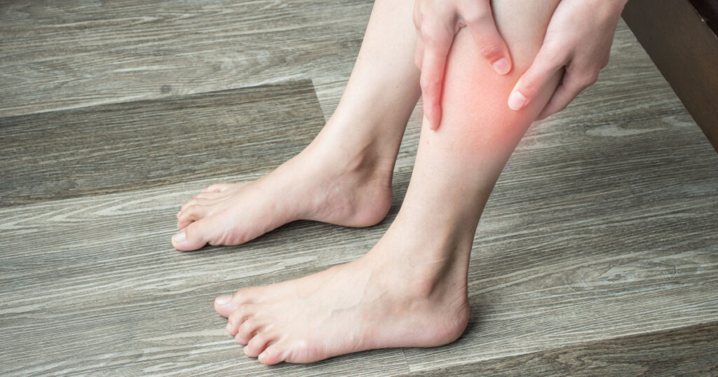 Closeup of woman hands holding and massaging her calf, suffering from calf pain. Calf pain may be muscle-related diagnoses, there are some potentially serious ones , like a blood clot or claudication.