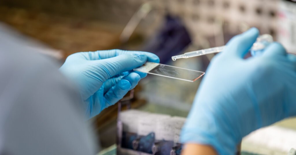 staining slide Pap smear for cytology,laboratory.