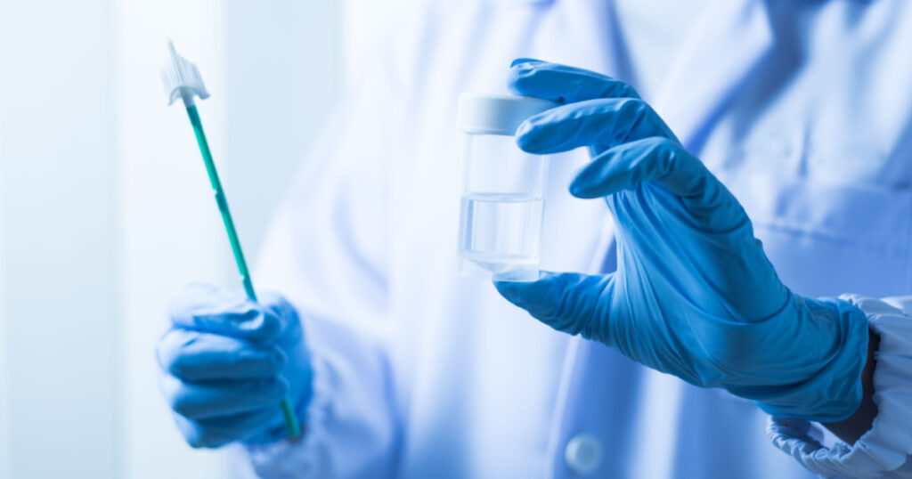 Doctor hand holding liquid base cytology set on blue background.Gynecologist working for vaginal and cervix pap smear patient in the obstetrics and gynecology department.Medical concept.