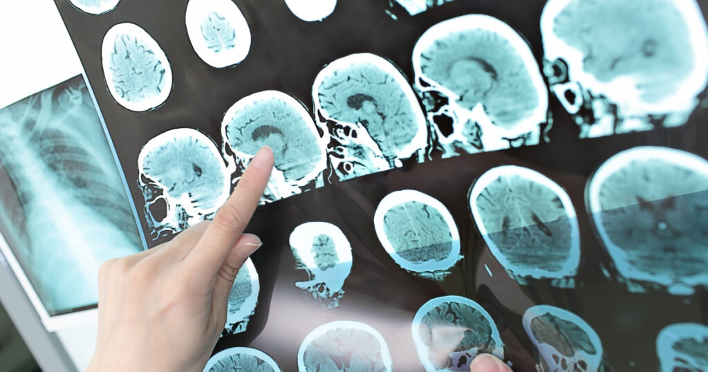 doctor view output CT scan.