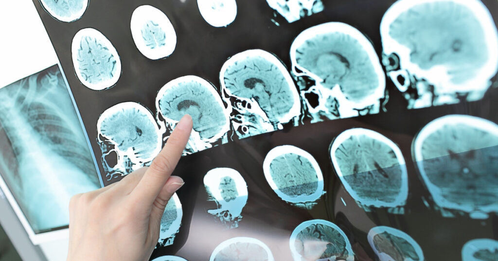 doctor view output CT scan.