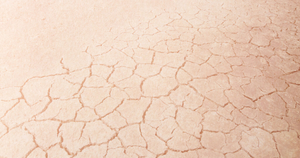 Close-up on dry woman skin texture with dry dessert. Skin care concept.