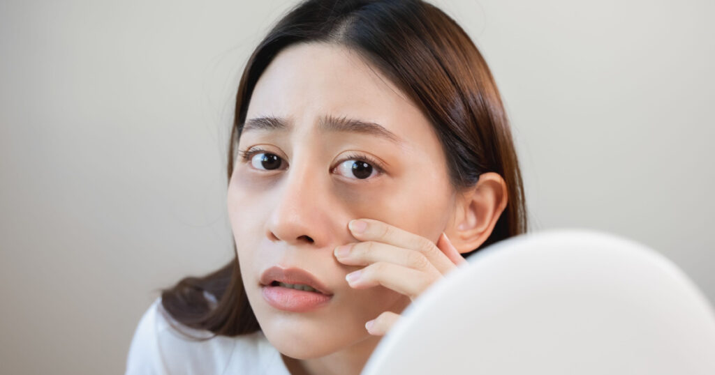 Sleepless Asian woman looking her face in the mirror and worry about dark circles under eyes