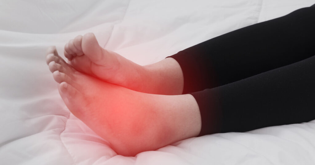 Foot swelling during pregnancy.,Swollen feet
