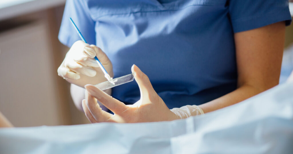 Vaginal Smear. Close up.