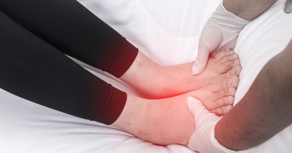 Foot swelling during pregnancy.,Swollen feet