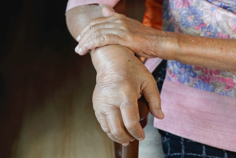 Elderly swollen hand or edema hand