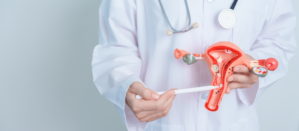 Doctor holding Uterus and Ovaries model. Ovarian and Cervical cancer, Cervix disorder, Endometriosis, Hysterectomy, Uterine fibroids, Reproductive system and Pregnancy concept
