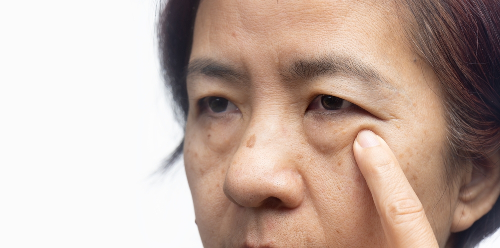 Senior asian woman worry about eye bags and dark spot.
