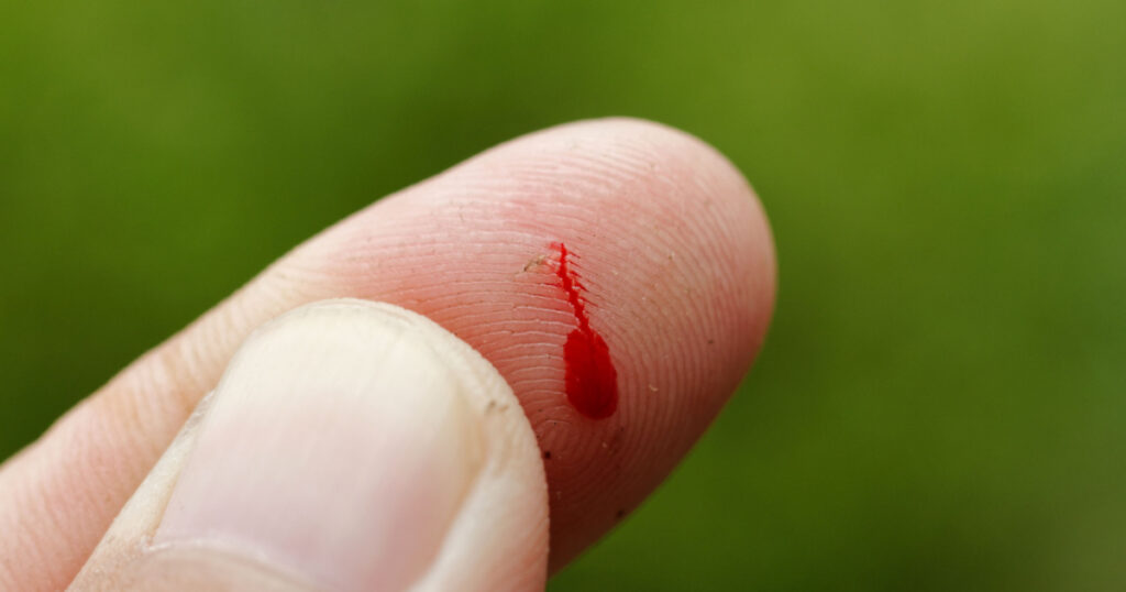 Accident on hand ,Drop of blood ,thorn cut on finger