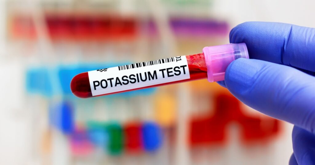 Blood sample of patient for Potassium test in laboratory. doctor with Blood tube and needle for Potassium test