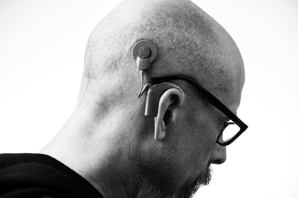 Hearing Impairment