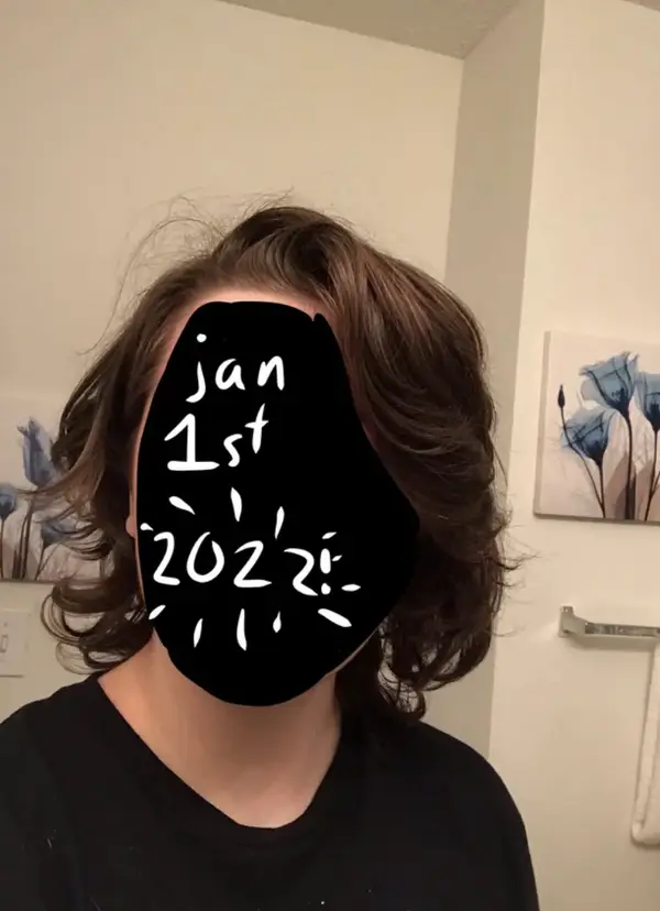human body A Year in Hair: Documenting the Journey of Growth