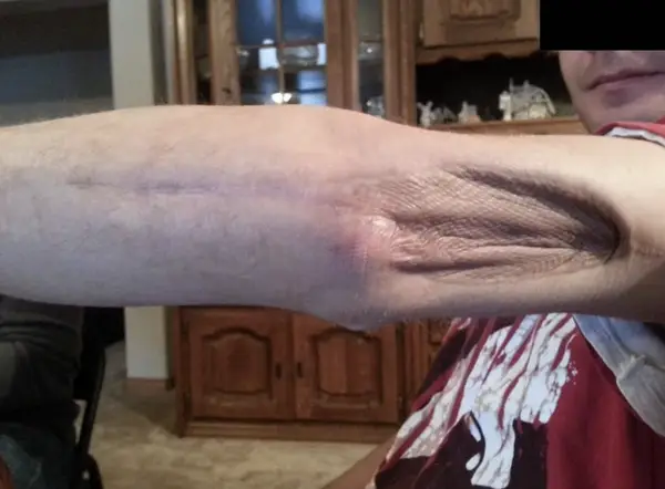 human body Healing's Aftermath: A Year in Recovery from the previous image