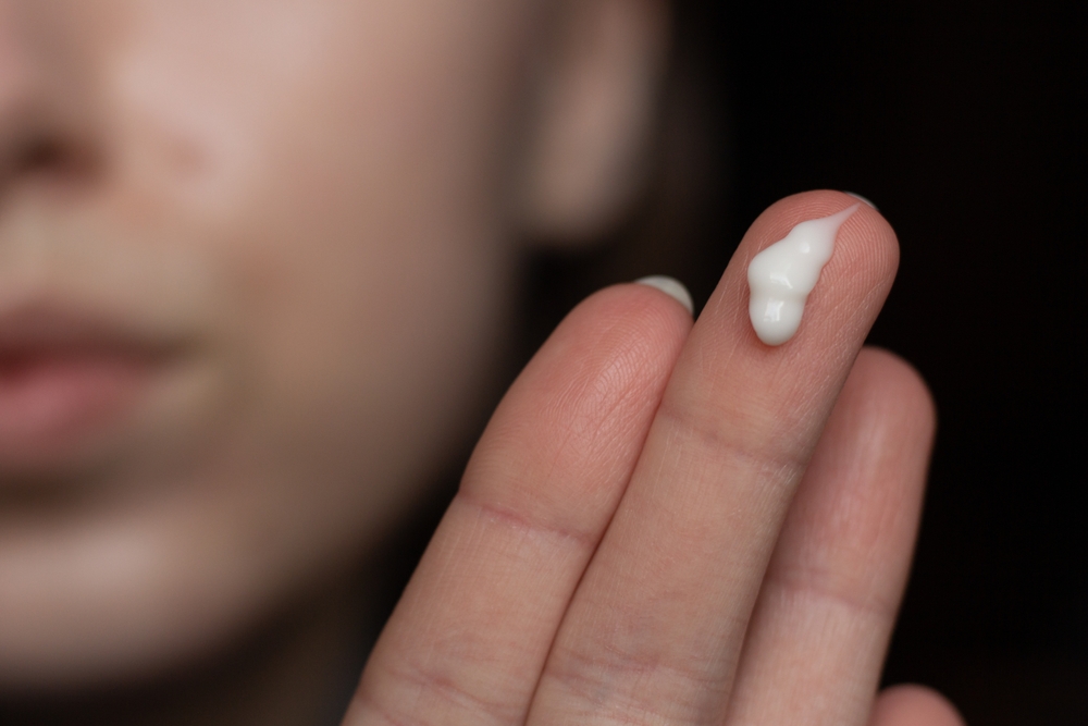 Closeup of a young woman applying prescription retinoid to her acne-prone skin with scarring and post-inflammatory erythema.