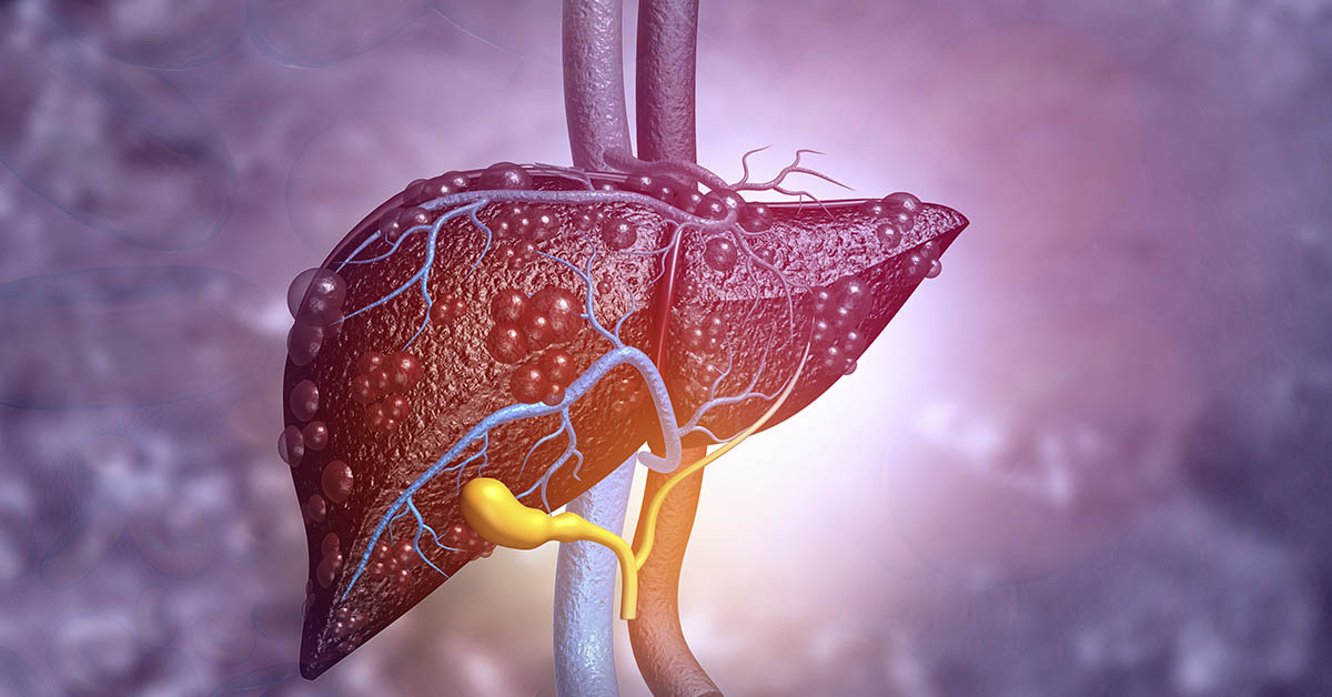 10 Signs of Liver Disease to Never Ignore
