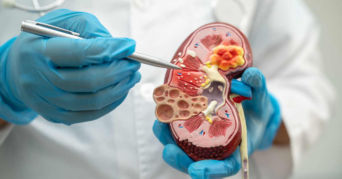 10 Warning Signs Your Kidneys Could Be Failing