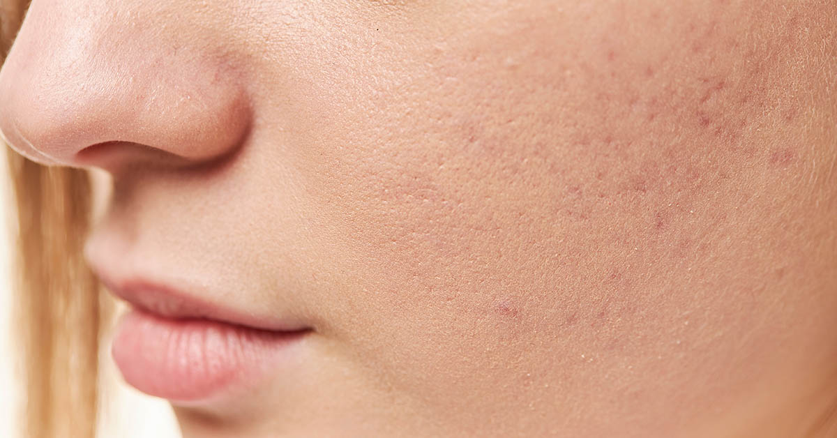10 Medical Conditions Revealed Through Our Skin