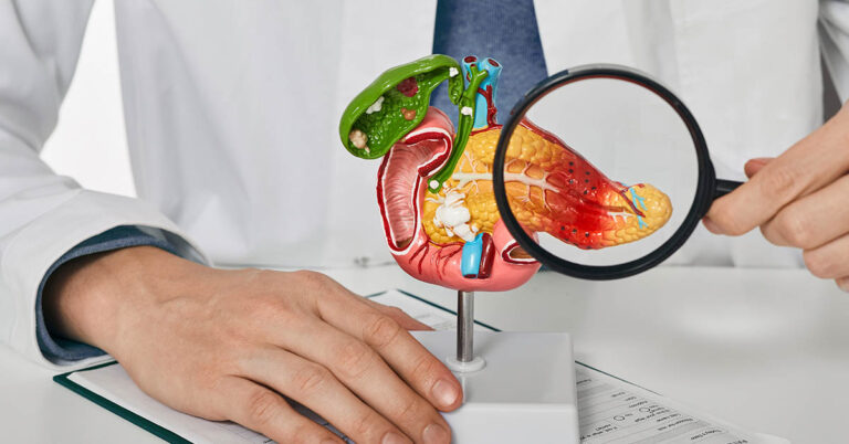 10 Signs of Pancreatic Cancer You Should Never Ignore - Featured image