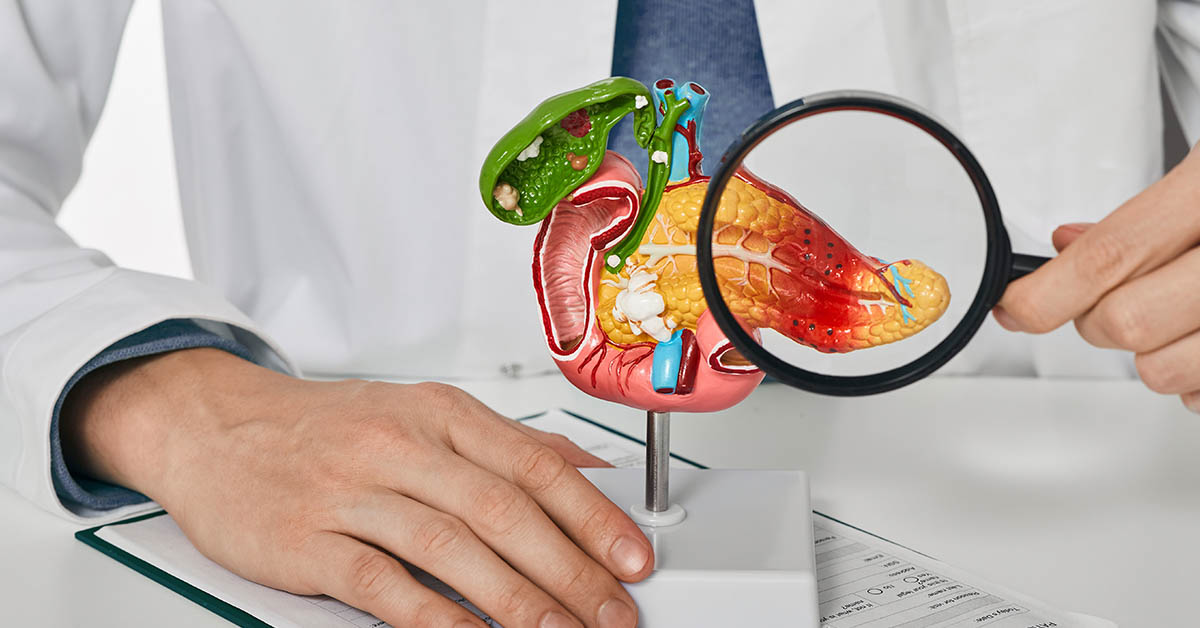 10 Signs of Pancreatic Cancer You Should Never Ignore