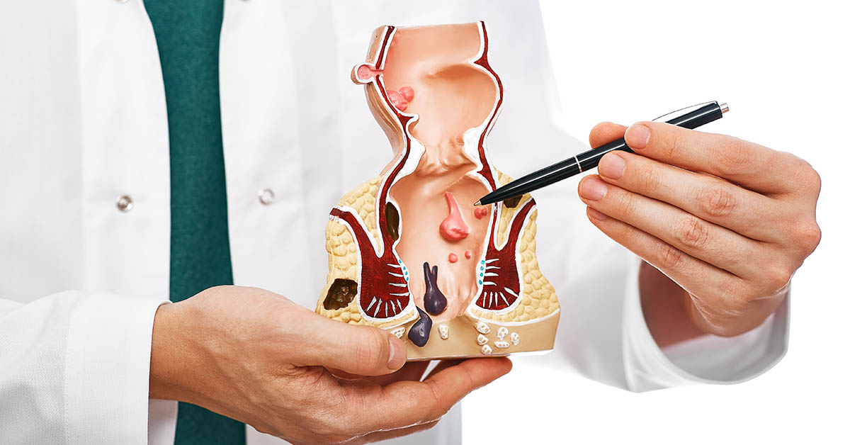 She Was Diagnosed With Stage 3 Cancer After Ignoring This ‘Embarrassing Symptom’